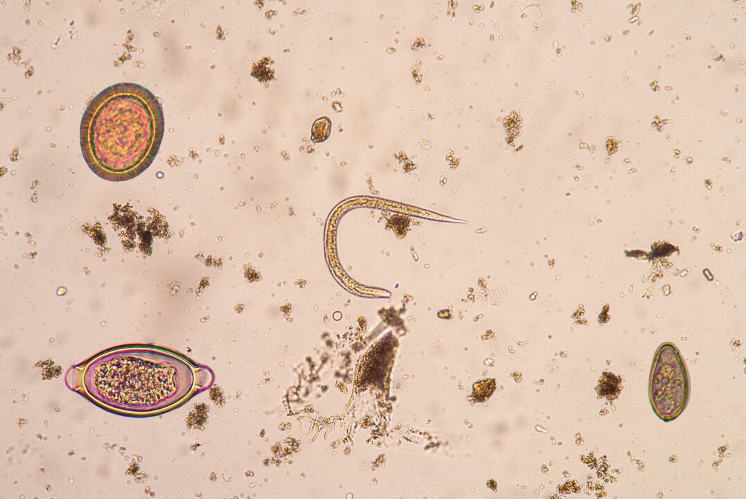 Deri altı parazitlerin larva evresi