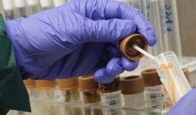 Parazitlerin analizini geçme ihtiyacı
