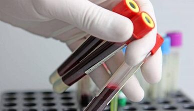 Vücuttaki parazitler için nasıl test yapılır