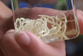 insan vücudundaki parazitler