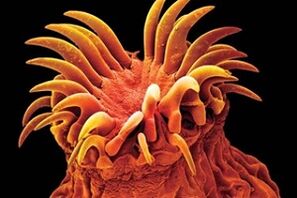 İnsanlarda trematod parazitleri