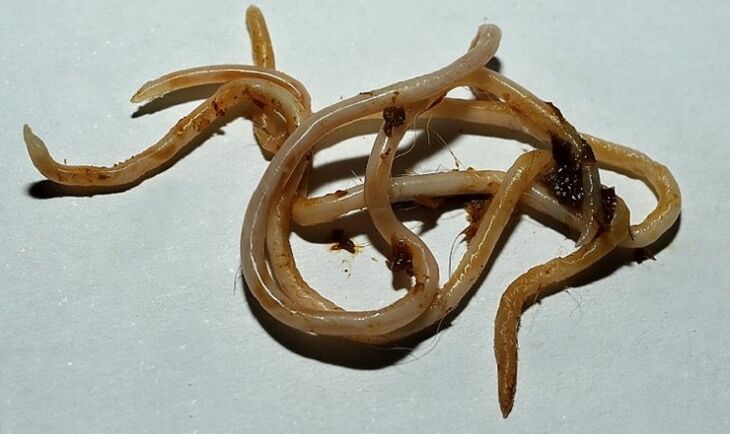 insan vücudundan toksokara